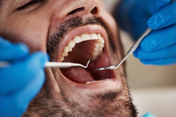 Oral Cancer Screening in West Richland, WA